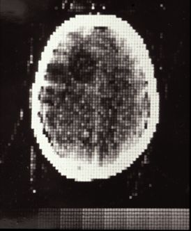 1971 head scan