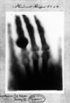 first medical x-ray
