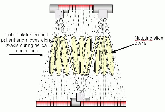 Figure 4: Slices produced using ASSR reconstructions