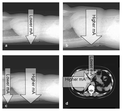 Figure 3: Varying patient attenuation and tube current for a) and b) patient size adapted mA, c) z-axis mA modulation and d) angular mA modulation