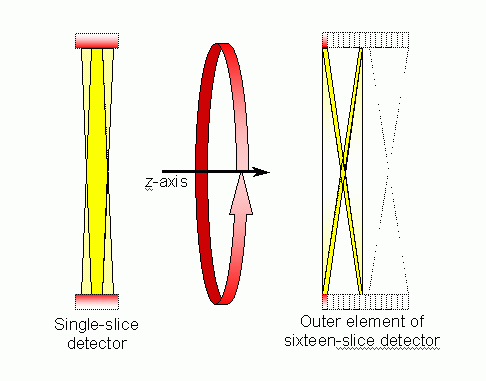 Figure 3: Cross sections through the volumes covered by rotation of single- and sixteen-slice scanners