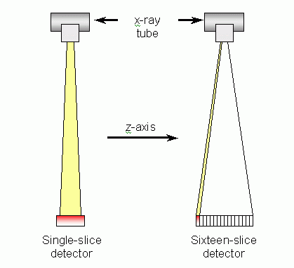 Figure 2: Single- and sixteen-slice detector scanners
