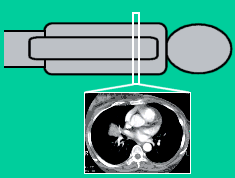 Each CT image represents a 'slice' through the patient